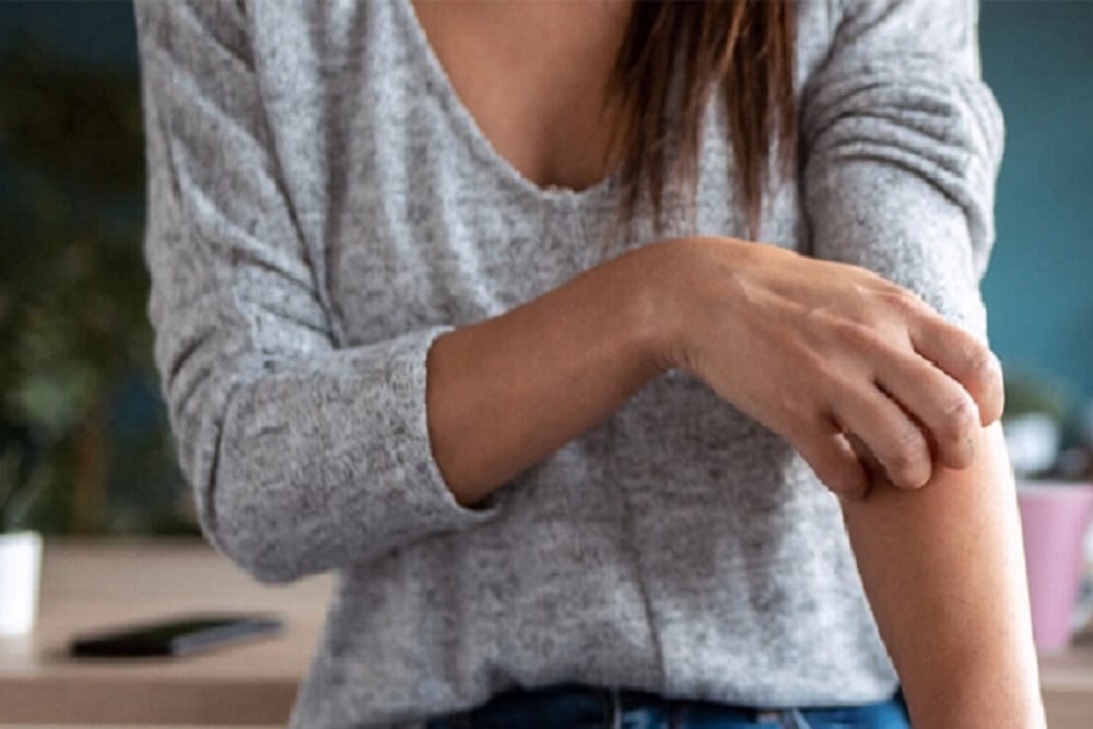 5 Common Psoriasis Triggers and Handle Them